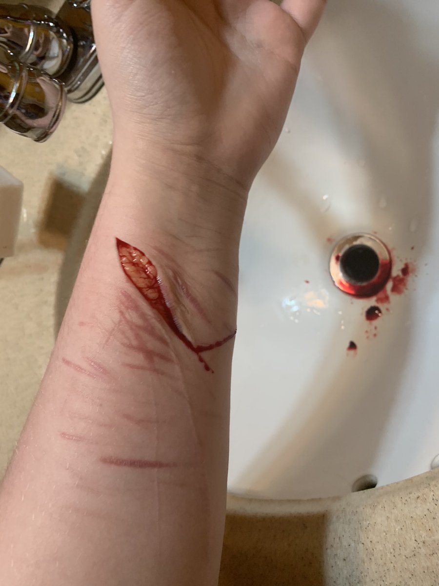 alrighty222's tweet photo. !!TW!!
this is now my fav
-
-
-
-
-
-
-
-
-
-
-
-

Shtwt bladetwt cuttwt barcodetwt styrotwt beantwt scartwt b4nd4idtwt catscratchtwt armgilltwt fasciatwt goretwt https://t.co/rqEj3q8BrW