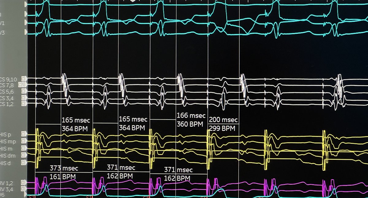 #EPeeps Isn’t EP elegant?