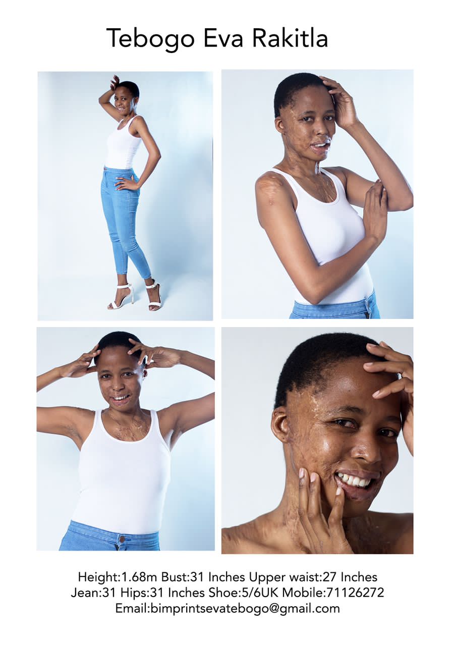 The Beautiful Imprints on X: My updated zcard 📸📇 raymondplusraymond  Model The Empire Bw #zcard #model #modelling #scarsofbeauty #thempirebw  #raymondplusgeofrey #tfp #collab #photographer #designers #mua #hairstylist  #brands #bodypositive