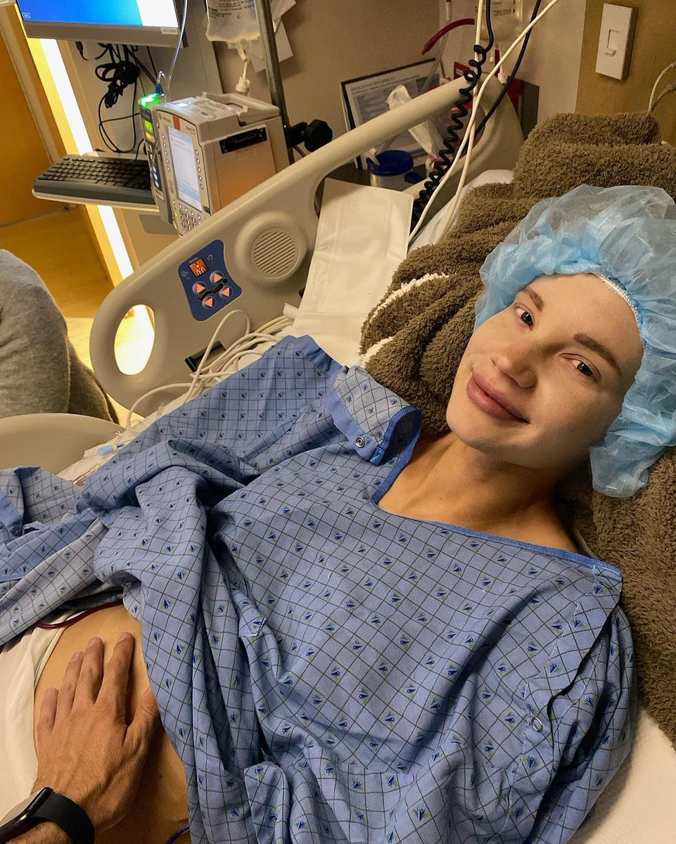 Patient_Story's tweet photo. "I was told there was little to no chance of saving my skin & nipple because of the invasive nature & the way the cancer grew."
- Delia Marie, #BreastCancer Thriver
Checkout more #Cancer Thriver storiesโฌ๏ธ
https://t.co/XkzH2enTZf
#bcsm #doublemasectomy #thepatientstory https://t.co/NzKJ2LficM