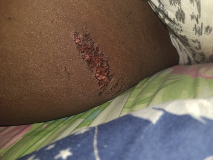 I was VERY SERIOUS about the PSA of not running with fat thighs. https://t.co/blolbSauXw