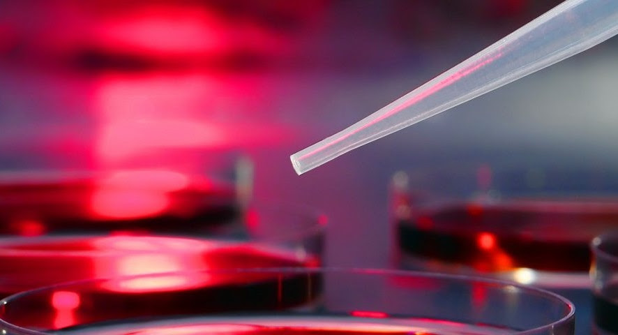 CFRI_CureCF's tweet photo. ABBVIE HALTS DEVELOPMENT OF ABBV-119, WILL CONTINUE WORKING TOWARD TRIPLE COMBO
Analysis revealed the #CFTR correction therapy did nothing when added to a two-drug regimen. A triple-combo therapy #Phase2Trial is expected early next year.
https://t.co/UOUOncU0Qw
#cysticfibrosis https://t.co/fIKd0NxCbU