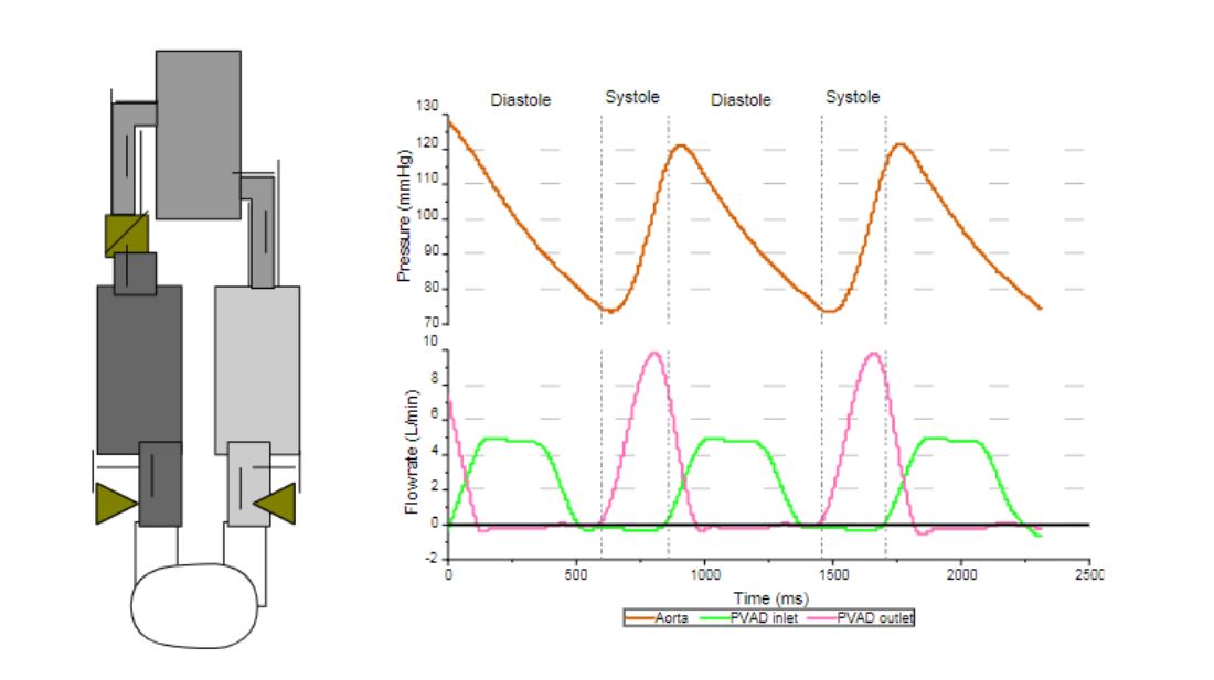 ArtifOrgans's tweet photo. #Effect of the #Bileaflet inlet valve angle on the flow of a #Pediatric #VentricularAssistDevice: #ExperimentalAnalysis
#OnlineFirst👉https://t.co/Sp2GS8rqTp
@Unifesp 🇧🇷| @MeneghiniJulio #FluidDynamics #ParticleImageVelocimetry https://t.co/RBUK8p0OdS