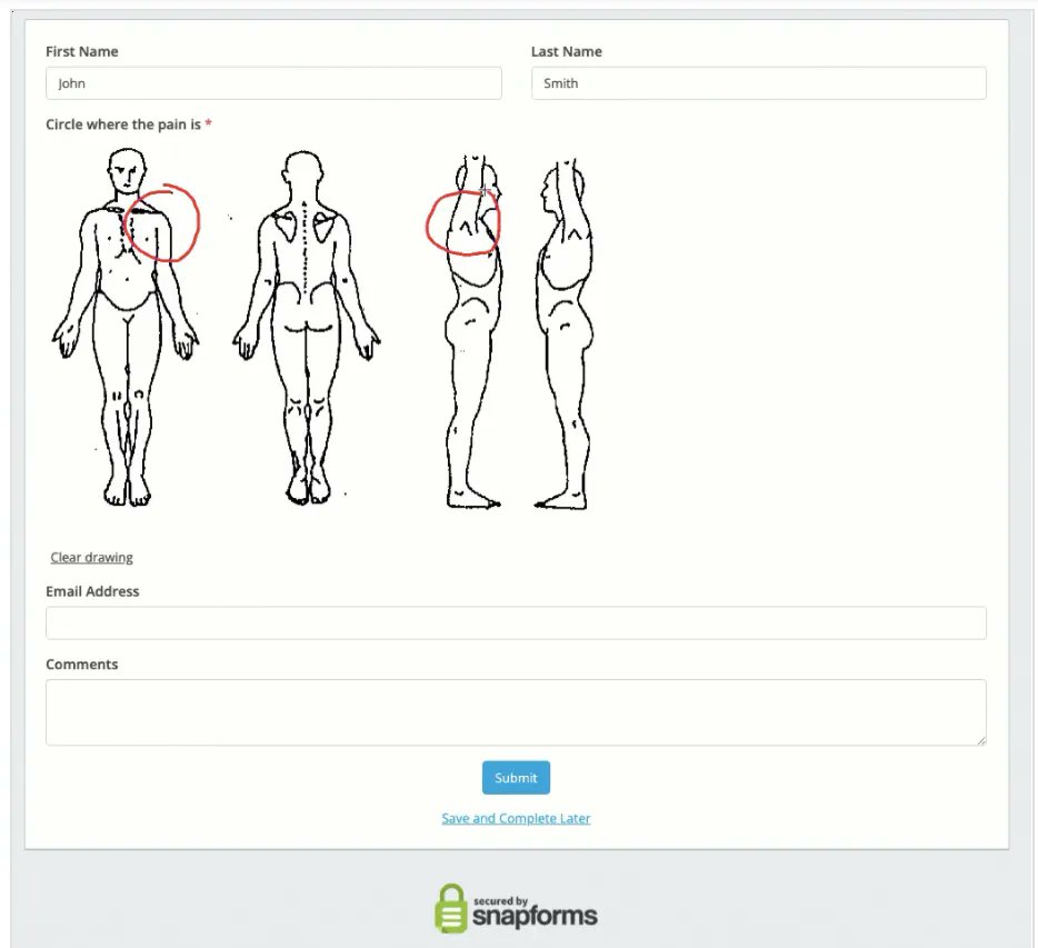 New feature! The Draw on Image field lets you add an image to your form that users can draw on to indicate areas that may need attention. This is a great tool for medical professionals to allow patients to showcase areas of pain! Check it out here: ​​snapforms.com.au/resources/draw…