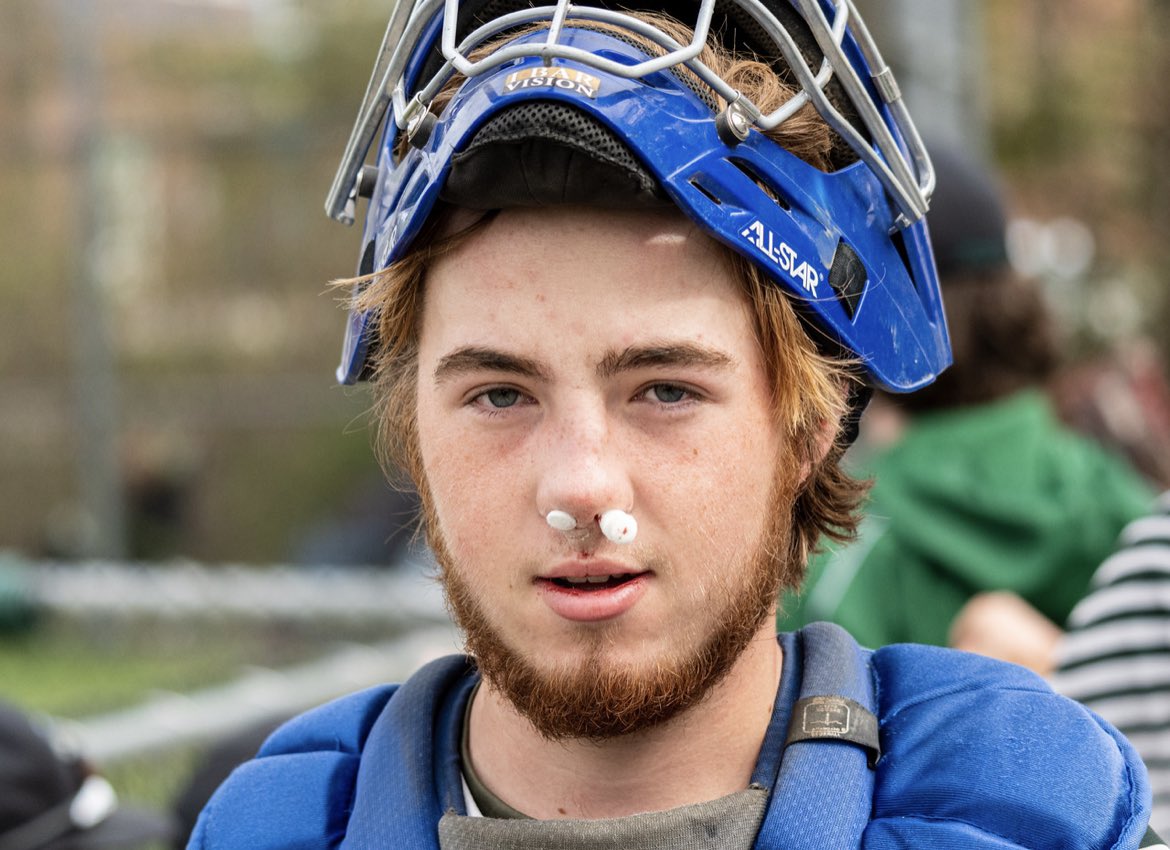 MHSHornetBASEBL's tweet photo. Hi. I’m Aidan Jones. Over the last week I have: 

Sprained my ankle ✅ 
Broke my nose ✅ 
Laid down the game winning bunt ✅ 
Made a MASSIVE block today to save a run and give us a chance to win ✅ 
Missed 0 innings of baseball through this ✅ 

Talk about a selfless player!! https://t.co/BGpKblEMmG