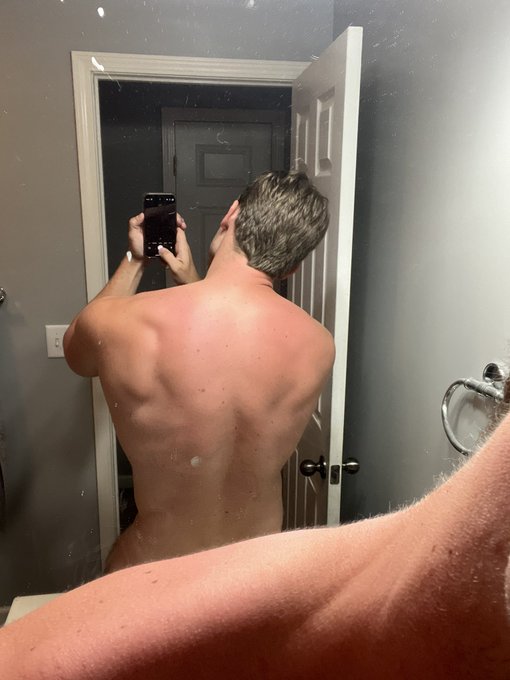 Sun burn is starting to heal. Should be back online tomorrow! The worst is finally over 🥹 https://t.
