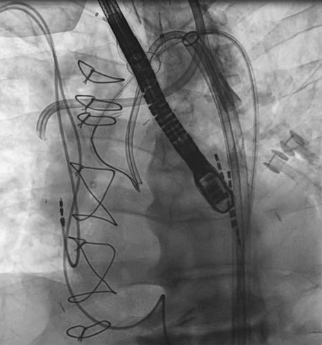 Mohamad Alkhouli tweet media