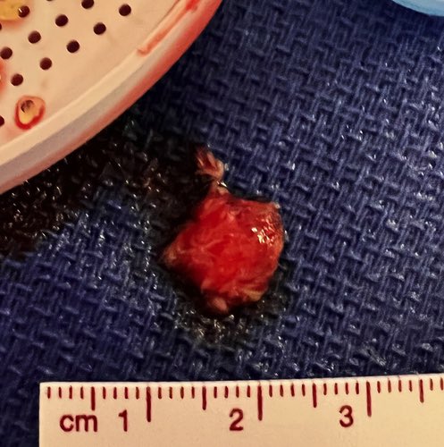 Mohamad Alkhouli tweet media