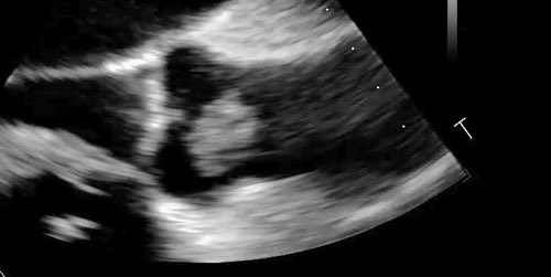 Mohamad Alkhouli tweet media