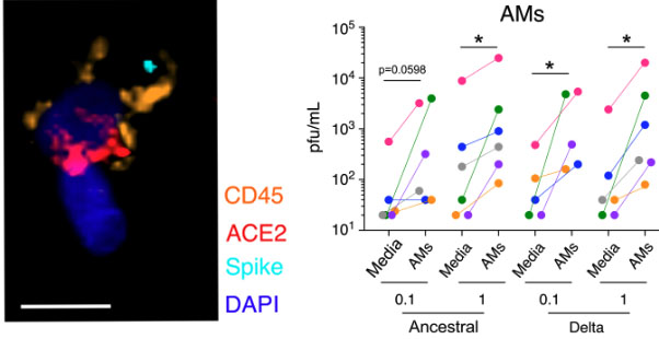 MaxKrummel's tweet photo. Think that SARS-2 really doesn't subvert immunity from the moment it hits the lung?

It infects primary lung macrophages--shown in direct infection of human lungs.  They are a depot and the virus replicates there with little killing of the macs. 

https://t.co/qW1rChy0nO

1/2 https://t.co/KpfKaKBQd5