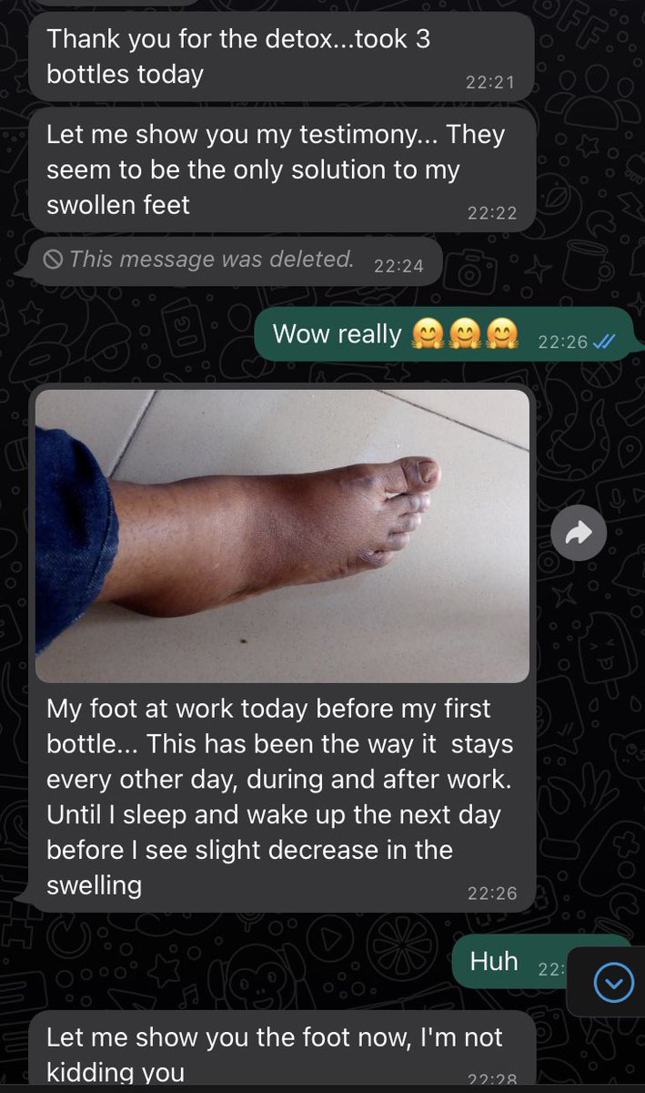 DenaiseblendzNg's tweet image. Reviews on @denaiseblendzNg 💃🏽#Health #postoperation #denaiseblendzNg #thursdayvibes