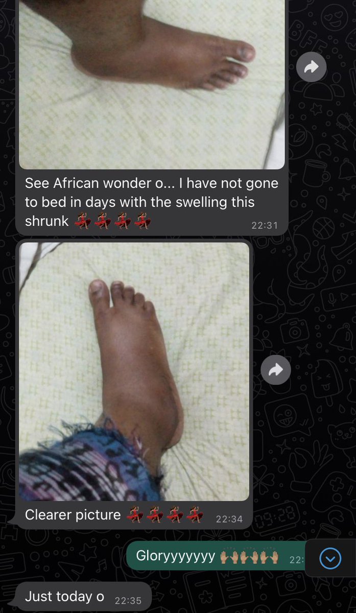 DenaiseblendzNg's tweet image. Reviews on @denaiseblendzNg 💃🏽#Health #postoperation #denaiseblendzNg #thursdayvibes