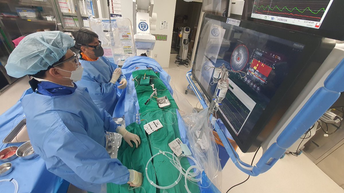 YongcheolKim2's tweet photo. It seems to be femoral approach, but reality is both SNUFFBOX!!!
-7-Fr EBU 3.5 via #ldTRA using 7-Fr Slender sheath for the anterograde approach
-5-Fr JR 3.5 via #RdTRA using 5-Fr Slender sheath for collateral flow from RCA
Let’s beccome #Snuffboxer !! https://t.co/Zr71YkVU4L