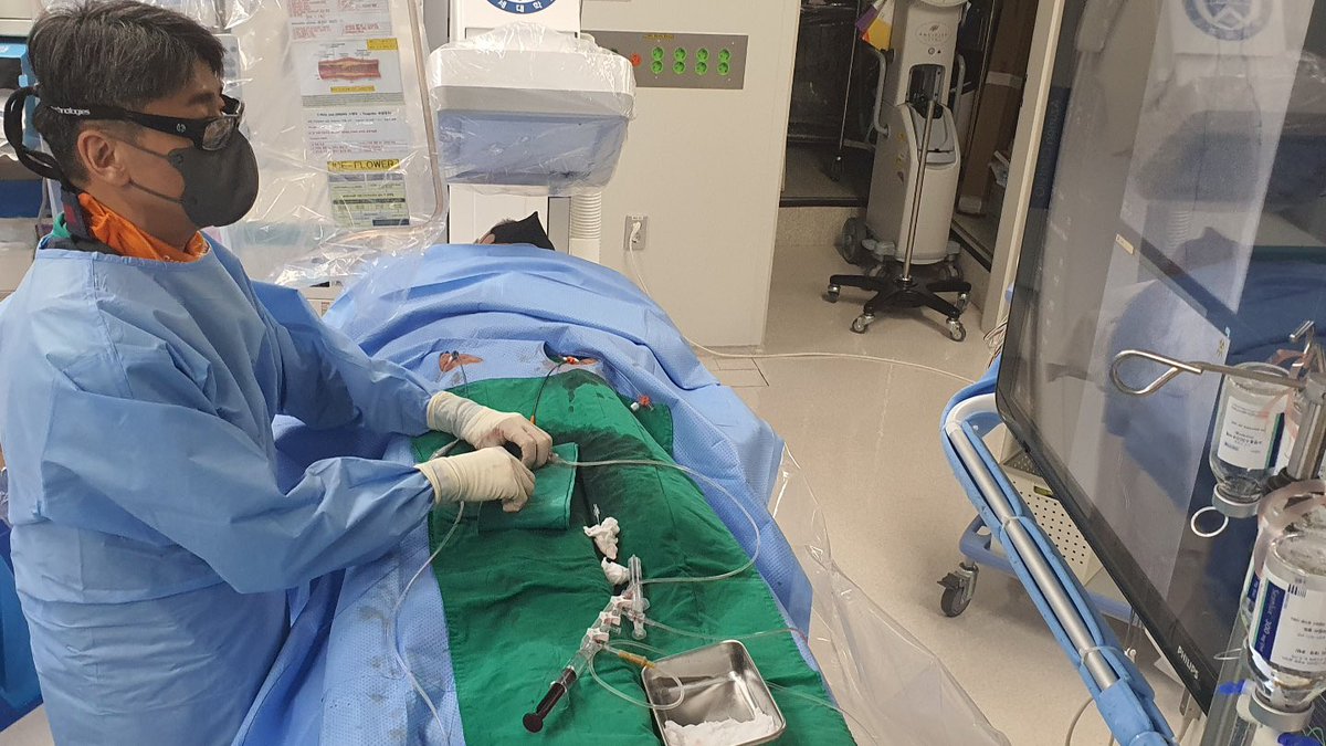 YongcheolKim2's tweet photo. It seems to be femoral approach, but reality is both SNUFFBOX!!!
-7-Fr EBU 3.5 via #ldTRA using 7-Fr Slender sheath for the anterograde approach
-5-Fr JR 3.5 via #RdTRA using 5-Fr Slender sheath for collateral flow from RCA
Let’s beccome #Snuffboxer !! https://t.co/Zr71YkVU4L