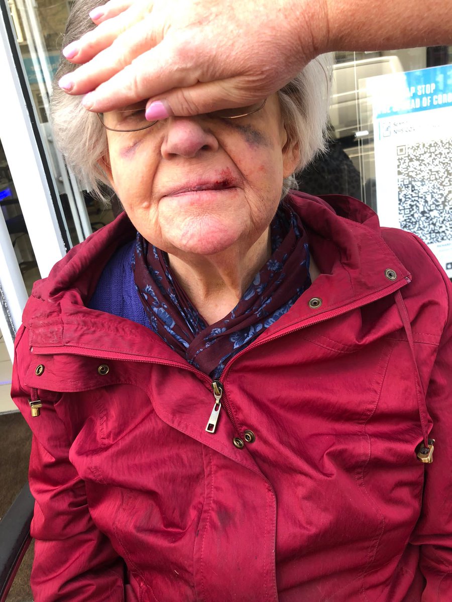 RichardHairUK's tweet photo. @LBRuT_Help this happened outside @RichardHairUK today. 3rd incident in 5 months. Could have been far worse if  this poor lady fell into the road with oncoming traffic. Lucky my team were there to help. This pavement needs fixing asap. https://t.co/bs2Drf6Jef