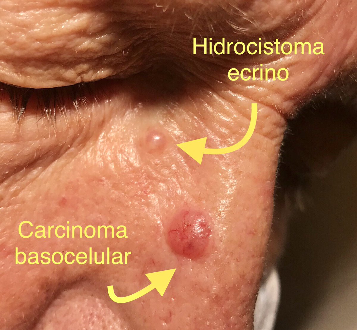 Julián Conejo-Mir tweet media