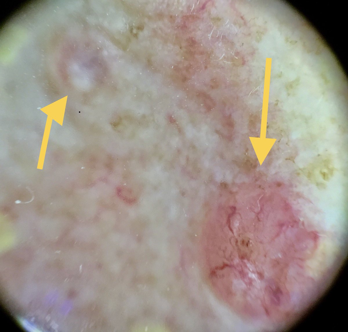 Julián Conejo-Mir tweet media