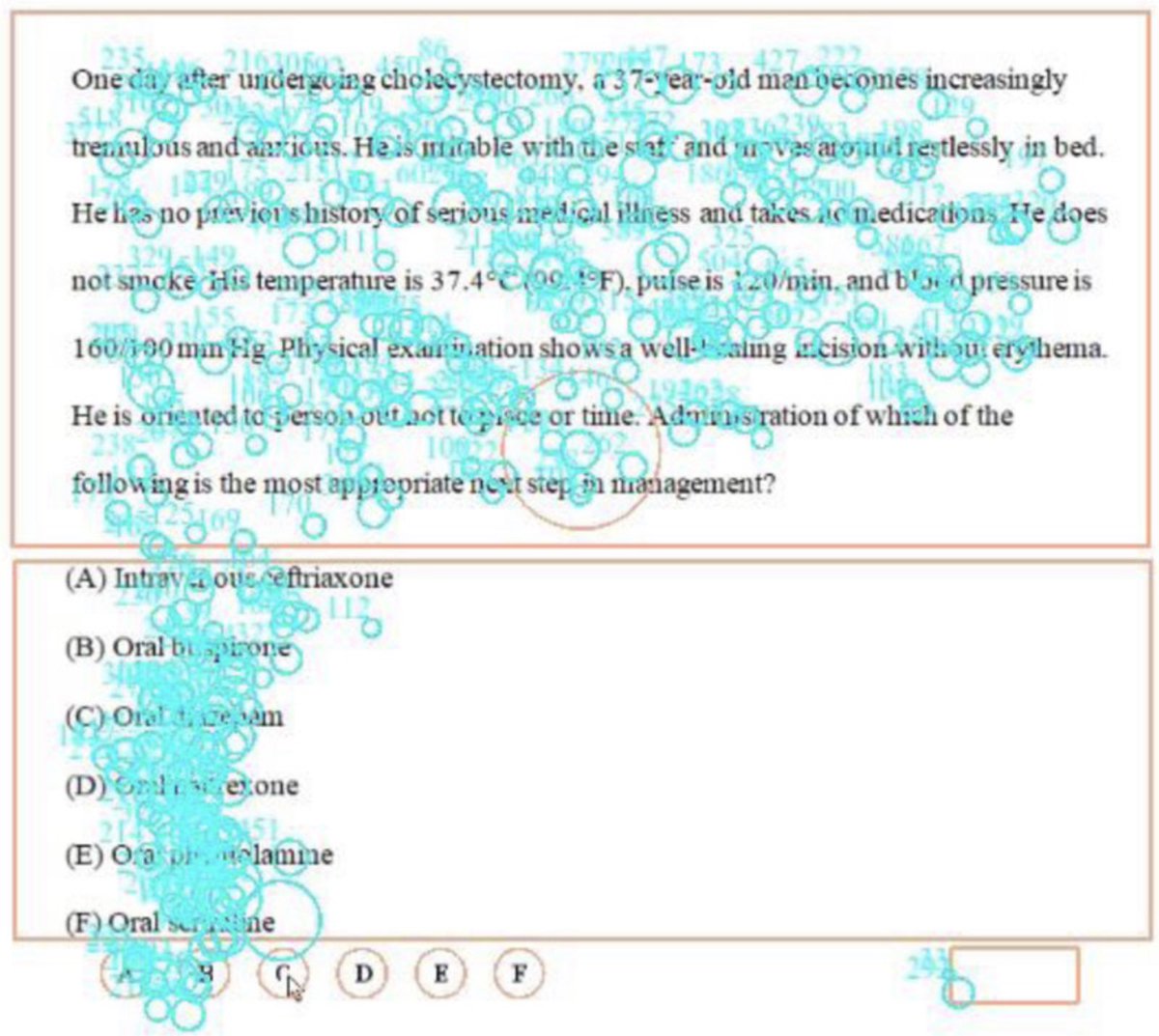 jbcarmody's tweet photo. This graphic is from an NBME eye-tracking study.

The blue circles demonstrate the location and duration of eye gaze while answering a multiple-choice question.

Turns out most examinees read questions from the beginning to the end (i.e., they don’t look at answer choices first). https://t.co/p3ddryyGzm