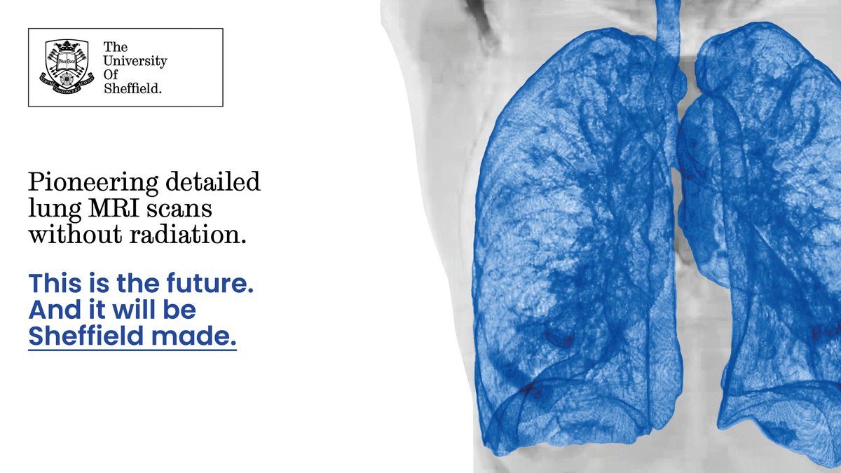 Sarahhowson36's tweet photo. Another great example of research from @sheffunimdh  showcasing how the faculty is transforming health and social care. @UosPolaris @ShefUni_IICD @insigneo   #REFResults #SheffREF2021 👇

https://t.co/sPNgybFIJh https://t.co/NBNRPpEWKG