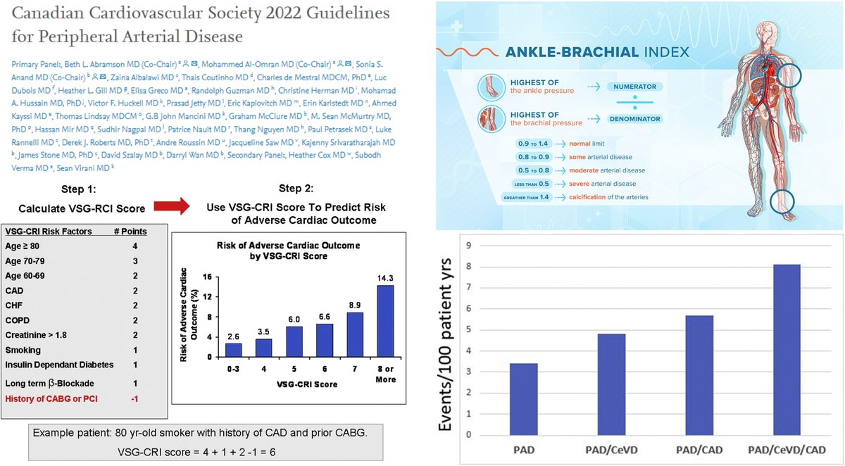 HaoYin20's tweet photo. Canadian Cardiovascular Society 2022 Guidelines for #PeripheralArterialDisease
"We recommend #SupervisedExercise programs as first-line therapy for patients with PAD and #IntermittentClaudication"
@CJCJournals @SCC_CCS_CEO
https://t.co/VSOexkxzXJ https://t.co/sXb2F2N7X7