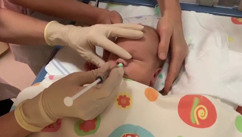 Mesenchymale stamcellen kunnen veilig via neusdruppels aan pasgeborenen met hersenschade na een herseninfarct worden toegediend. Dit blijkt uit de klinische studie van de onderzoeksgroepen van <a href="/chanijboer/">Cora Nijboer</a> en Manon Benders van het <a href="/UMCUtrecht/">UMC Utrecht</a> 
umcutrecht.nl/nl/over-ons/ni… #childhealth