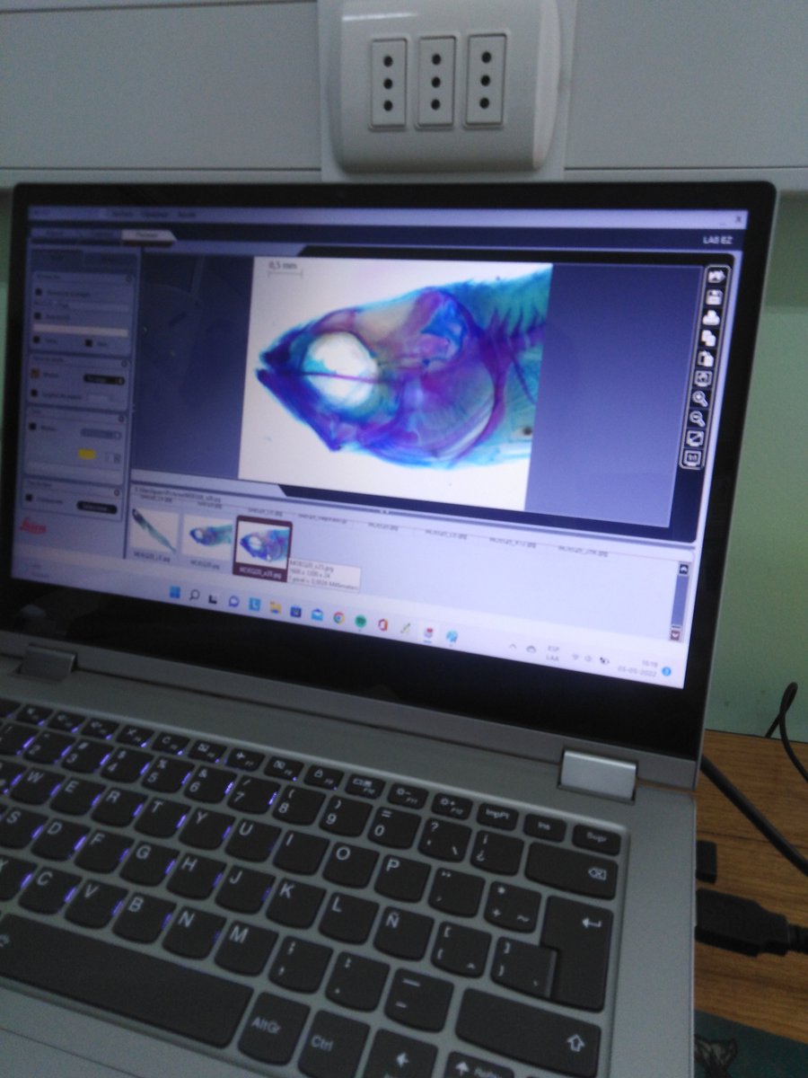 LabitiL's tweet image. El es Luis Guerra, estudiante de Biología Marina UV, y está realizando su Seminario sobre desarrollo morfológico de larvas de Blennioidei de Chile central.