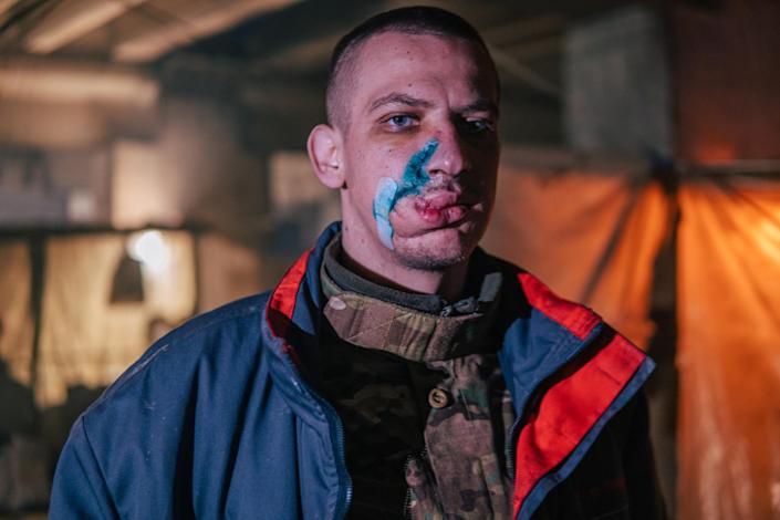 jeffreybacic's tweet photo. Lt. Ilya #Samoilenko, a staff officer for the elite 🇺🇦 #AzovRegiment, shares harrowing photos of wounded soldiers in besieged #Mariupol's #Azovstal steel plant
Doctors have been treating severed limbs, head wounds, severe lacerations, gunshot wounds & broken bones
#SaveMariupol https://t.co/b4VJBWNaPU