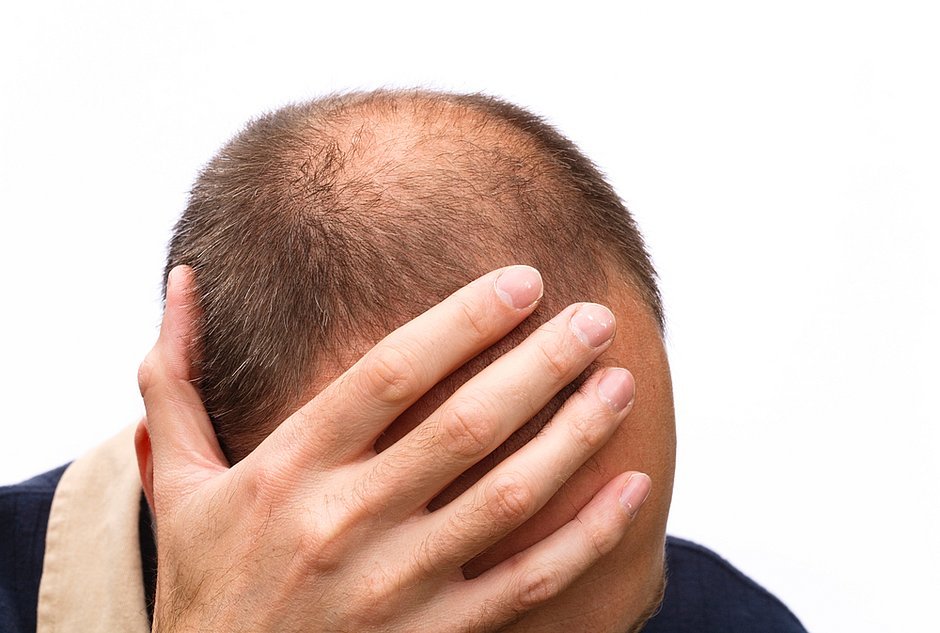 correio24horas's tweet photo. Chamar homem de 'careca' é assédio sexual, decide tribunal formado por calvos

'Comparado a falar sobre os seios de uma mulher', argumentaram britânicos https://t.co/GT7JaEFPd9 #correio24h https://t.co/p50bzfAnlv
