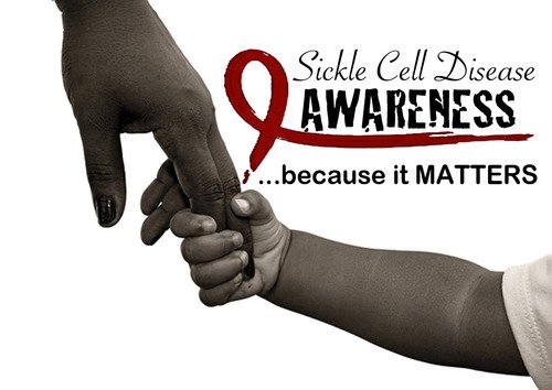 Stop The Stigma 
People with SCD often suffer from extreme pain and fatigue. The frequent pain episodes and extreme fatigue can lead to absenteeism from both school and work. This may cause a false impression that the person with SCD is “lazy.”
<a href="/uscrfuganda/">Uganda Sickle Cell Rescue Foundation</a> <a href="/TheUMAofficial/">Uganda Medical Association</a>