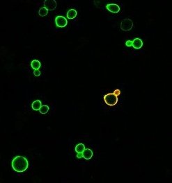 MT180FR's tweet photo. Une fois sûre que mes levures charbonnent bien, je vais chercher LE bon nanocorps: celui qui reconnaît mon virus. Pour le voir facilement, je rends mon virus rouge fluorescent ! Si mon nanocorps l'attrape, la levure qui le produit devient rouge. 
Et 🟢 + 🔴 = 🟡 ou 🟠. https://t.co/vMBRgrr2li
