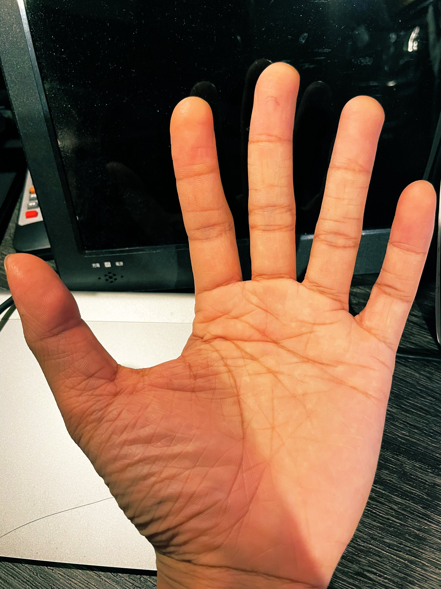 Yoshihiro A O Gアルバム出た ギター弾きながら改めて自分の手観察してみたんだけど 指が長いっていうより手のひらがデカイよねホント 皺が多いのとなんか色が変なのは小学生の頃から T Co Bfdyjluhol Twitter