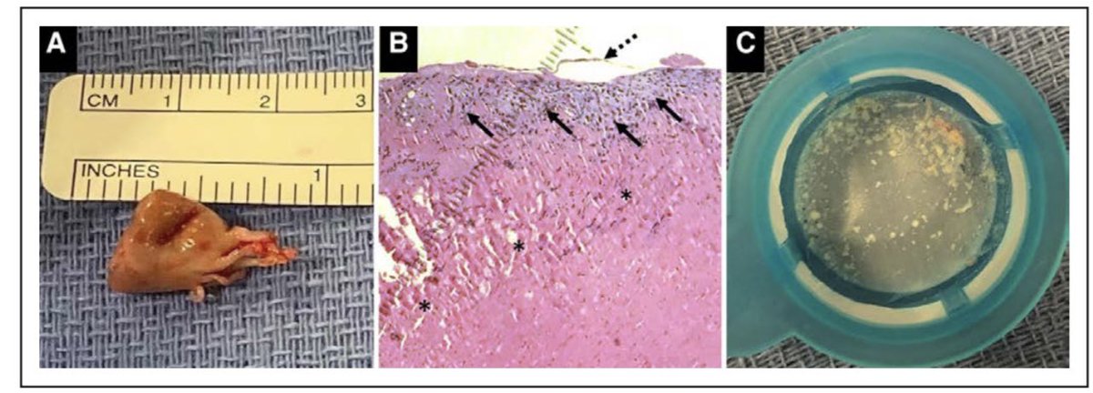 Michael Bode tweet media
