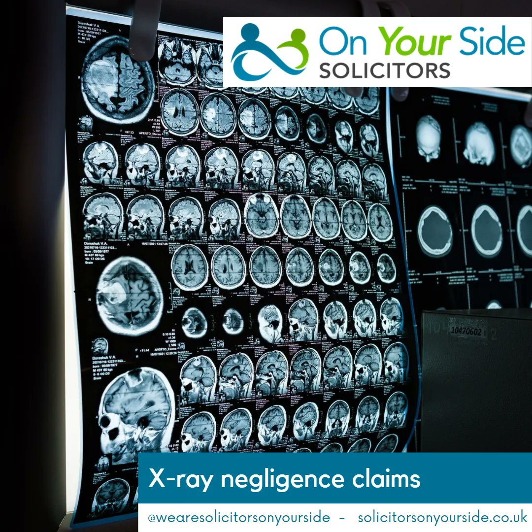 SOYS_UK's tweet photo. X-ray negligence claims

Read all about it in our latest article: https://t.co/EMhhrvbjK7

#solicitors #law #lawfirm #lawyers #legal #legaladvice #lawyer #conveyancing #solicitor #familylaw #personalinjury #litigation https://t.co/oqqa3WRDrP