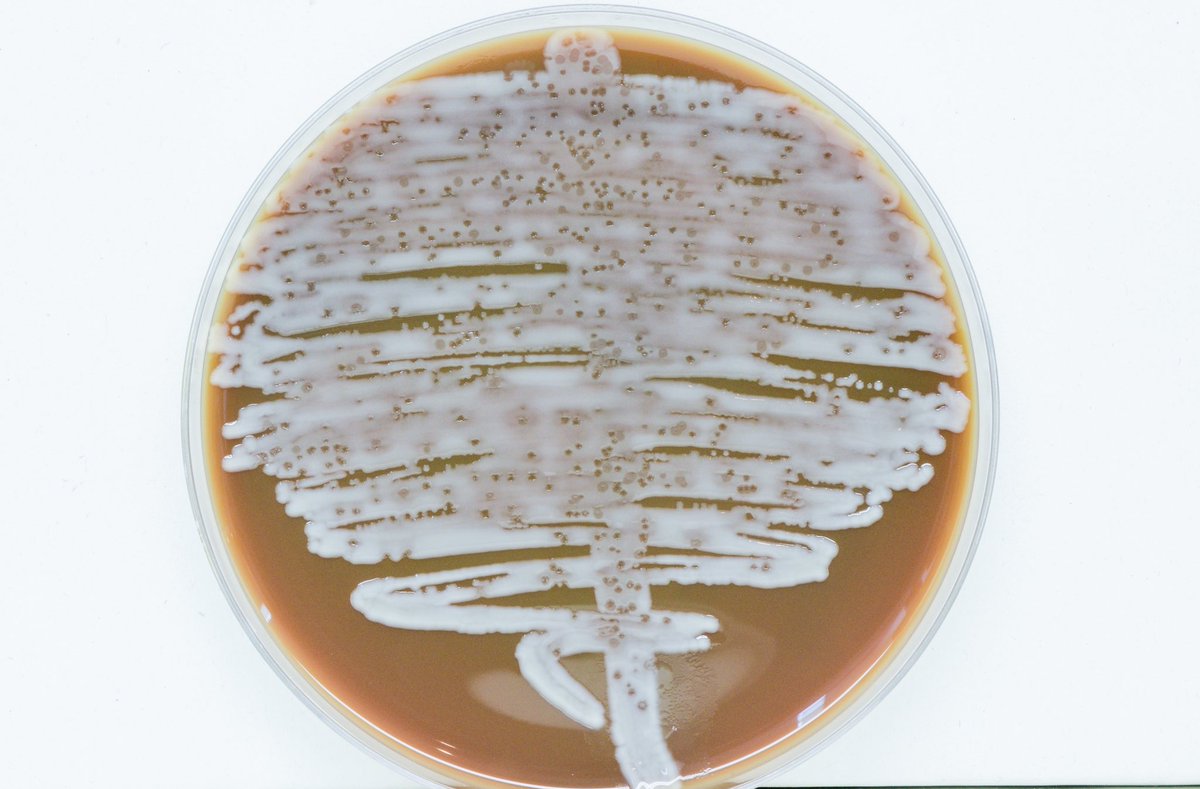micro_hculb's tweet image. #SaberySembrar
Cultivo de orina en agar chocolate tras 24h de incubación. 
Qué podría explicar este hallazgo?? 🤔
