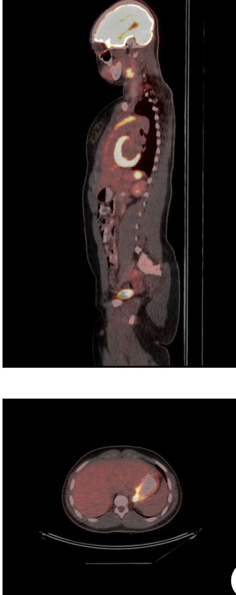 #التصوير_المقطعي_البوزيتروني (#PET)
 هذا الفحص يوضح كيفية عمل الأعضاء والأنسجة داخل الجسم. تساعد هذه...
