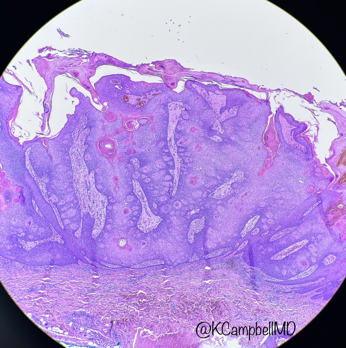 Katelynn Campbell tweet media