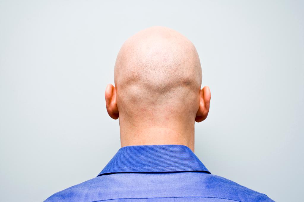 nypost's tweet photo. Calling men 'bald' at work now considered sexual harassment in the UK https://t.co/0D6HmBLOUg https://t.co/Y4FW1GEgEU