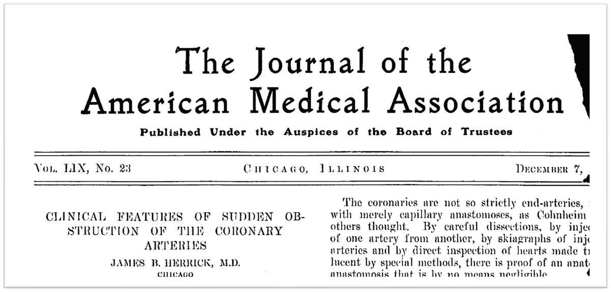 1/6
In James Herrick's original description of acute MI in 1912 he wrote that "the importance of absolute rest in bed for several days is clear."

This admonition was meant to reduce stress on a necrotic wall and mitigate catastrophic rupture.

pubmed.ncbi.nlm.nih.gov/6350634/