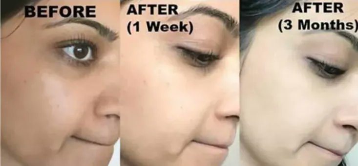 Wow, that's amazing.
alibaba.com/product-detail…
#Skincare    #keepyoung  #beautiful  #skincareroutine  #skinroutine #celebrityskincare  #beautysecrets  #satisfying #makeu