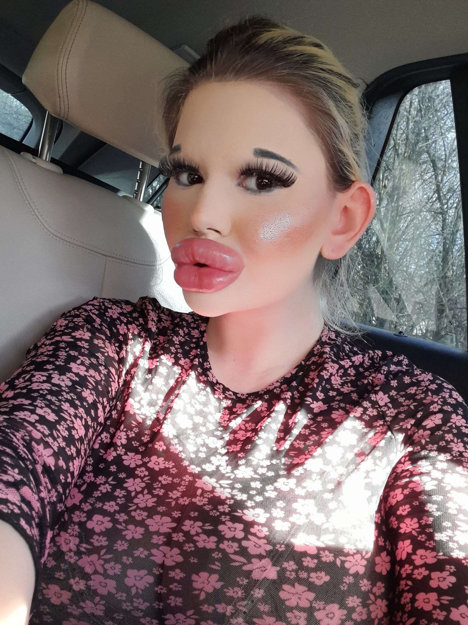 Andrea Ivanova on X: "#world #famous #girl #biggest #lips #silicone  #implants #bulgarian #barbie #grandes #labios #mundo #tiene #cool #makeup  #blonde #hair #sweet #beautiful #lovely #love #injections #lip #fillers  #hialyronic #acid #chin #jawline #