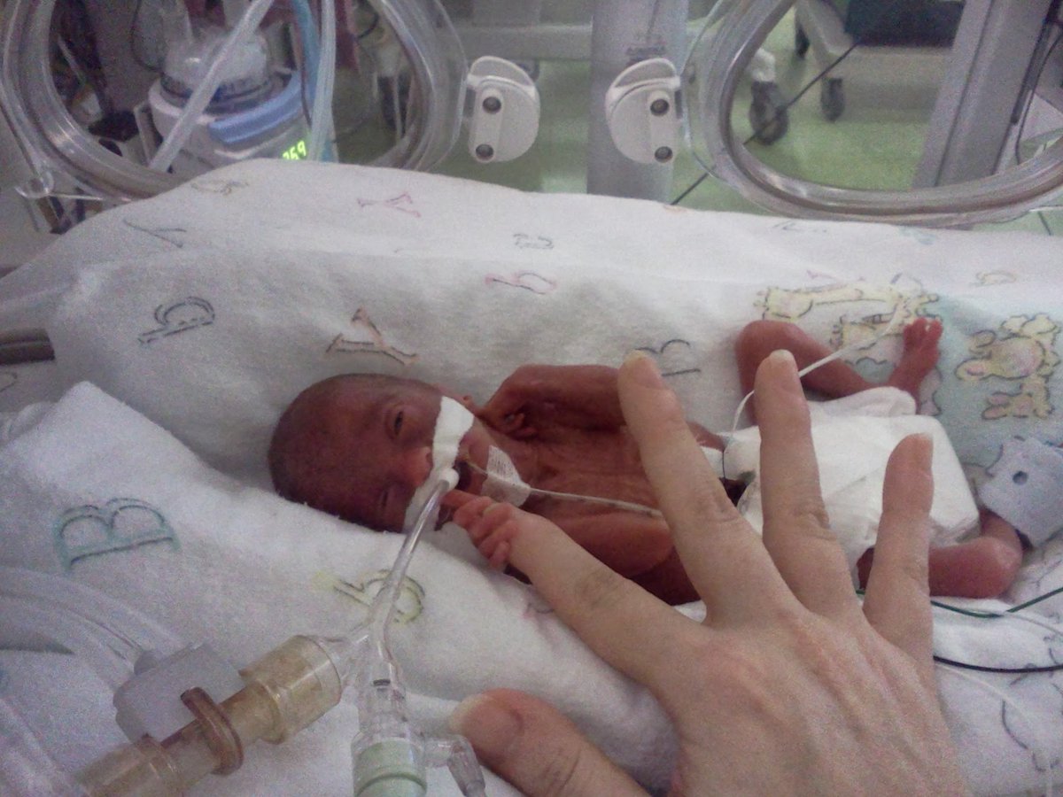 JenniferDegl's tweet photo. My micro preemie turned 10! It's been a long decade with many ups/downs, trauma, healing & love. We made it despite the odds against us. Click to read more about our journey with prematurity. Happy 10th Birthday to my Joy! #preemie #NICU #fromhopetojoy
https://t.co/idMKYv5JLq https://t.co/8DEKaSMxrM