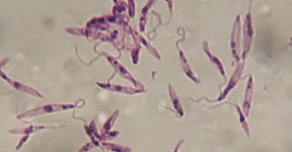 SaludISCIII's tweet photo. 📍 Una revisión sobre una familia de proteínas de los parásitos que causan la leishmaniasis, publicada por investigadores del #ISCIII y el @CBMSO_CSIC_UAM, aporta información que puede facilitar la búsqueda de nuevos tratamientos.

📰 #NoticiasISCIII ➡️ https://t.co/MopJUmogMd https://t.co/akVa6RuoQn