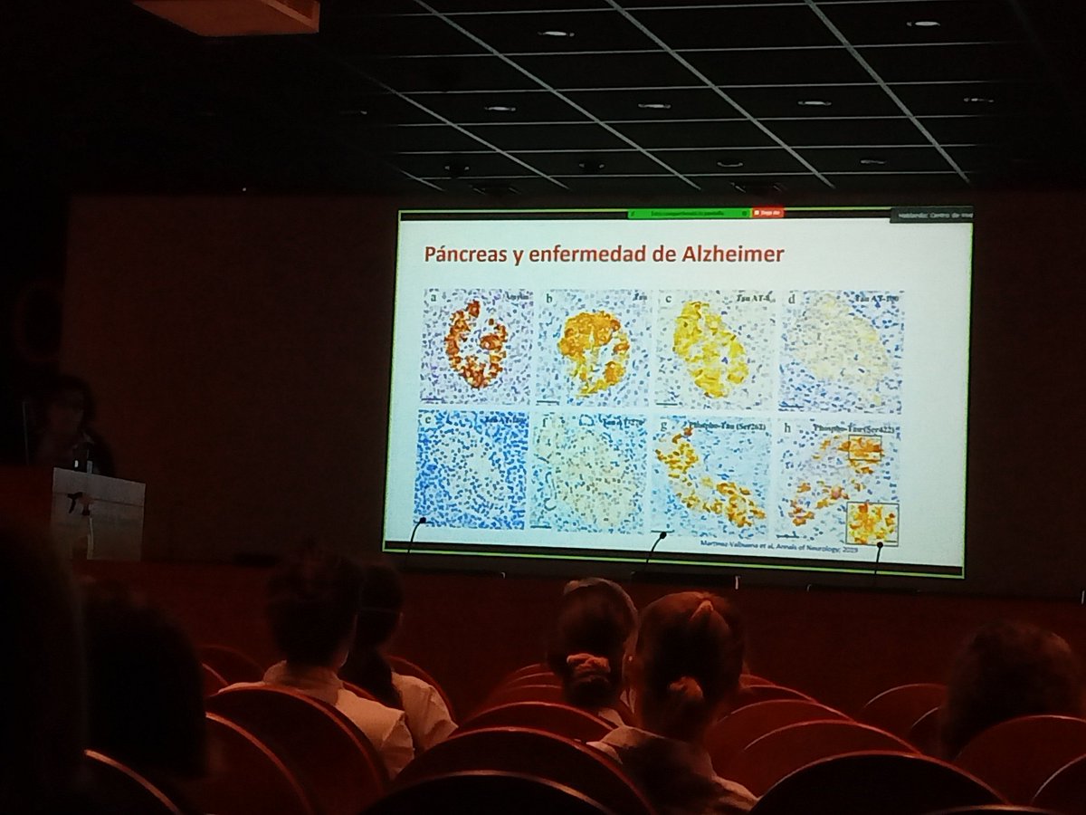CIMA_unav's tweet photo. Escuchando avances en #Parkinson y #Alzheimer y su relación con la #diabetes y la #amilina,  de la mano de la Dra.Luquin de nuestro Programa de Neurociencias y de @ClinicaNavarra @idisnanavarra https://t.co/OfK94h04gF