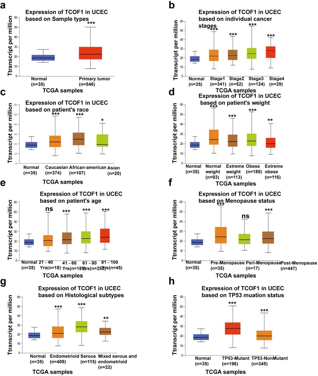 CEOGjournal's tweet photo. #TCOF1 is Identified to be an Unfavorable #Biomarker and is Associated with #Molecular #Classification in #Endometrial #Cancer
🥳the first paper of Special Issue: Current Research on Endometrial and #Ovarian #Cancers
🔗https://t.co/dSqg9el51s https://t.co/LgfgFBzAQm
