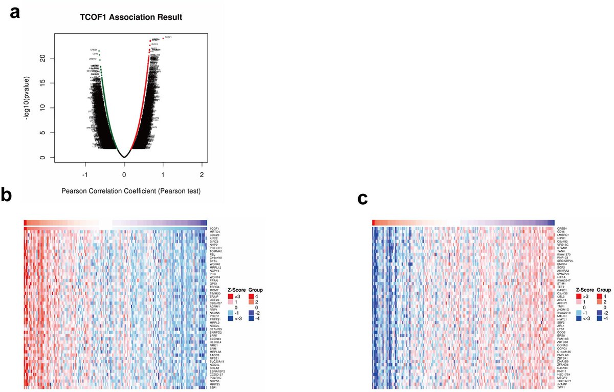 CEOGjournal's tweet photo. #TCOF1 is Identified to be an Unfavorable #Biomarker and is Associated with #Molecular #Classification in #Endometrial #Cancer
🥳the first paper of Special Issue: Current Research on Endometrial and #Ovarian #Cancers
🔗https://t.co/dSqg9el51s https://t.co/LgfgFBzAQm
