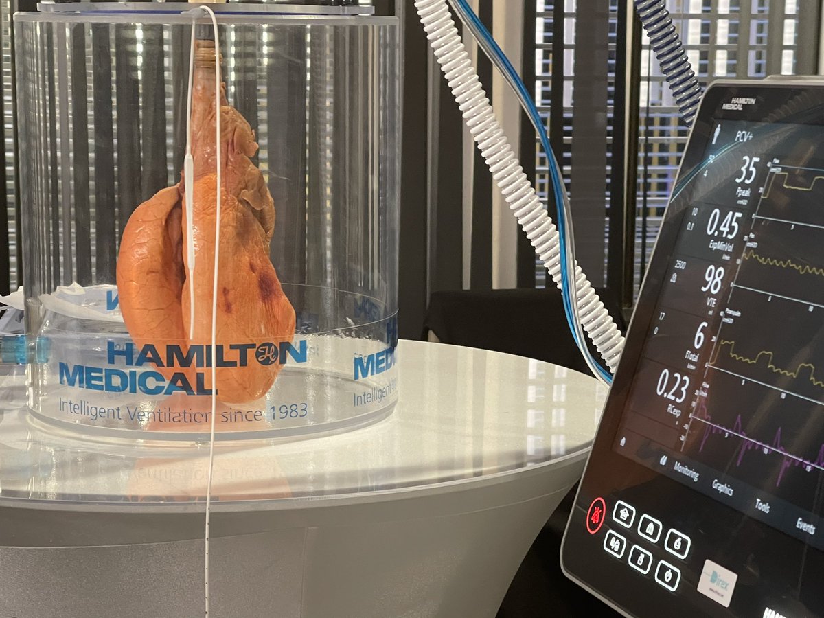 FOAMecmo's tweet photo. Clinical case to open mechanical ventilation #LIVES40 workshop... #ARDS pt not tolerating NIV/cannot breath
🫁 how to assess resp mechanics/set up MV
🫁 how to use Pes to monitor trans pulmonary P/breathing efforts
🫁 principles/use of APRV
🫁 lung/diaphragm #POCUS
🫁 EIT
@ESICM https://t.co/U0GYqh6jAx
