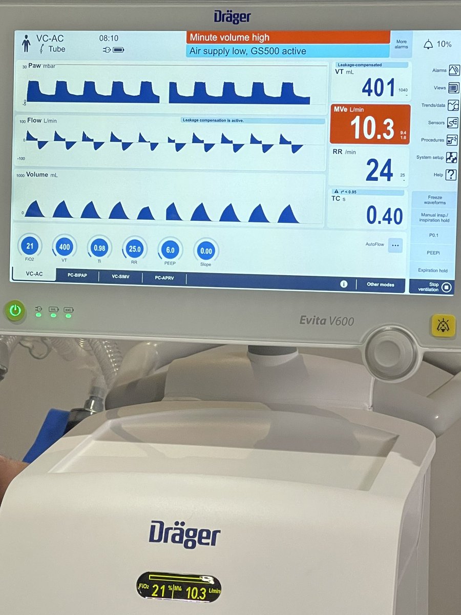 FOAMecmo's tweet photo. Clinical case to open mechanical ventilation #LIVES40 workshop... #ARDS pt not tolerating NIV/cannot breath
🫁 how to assess resp mechanics/set up MV
🫁 how to use Pes to monitor trans pulmonary P/breathing efforts
🫁 principles/use of APRV
🫁 lung/diaphragm #POCUS
🫁 EIT
@ESICM https://t.co/U0GYqh6jAx