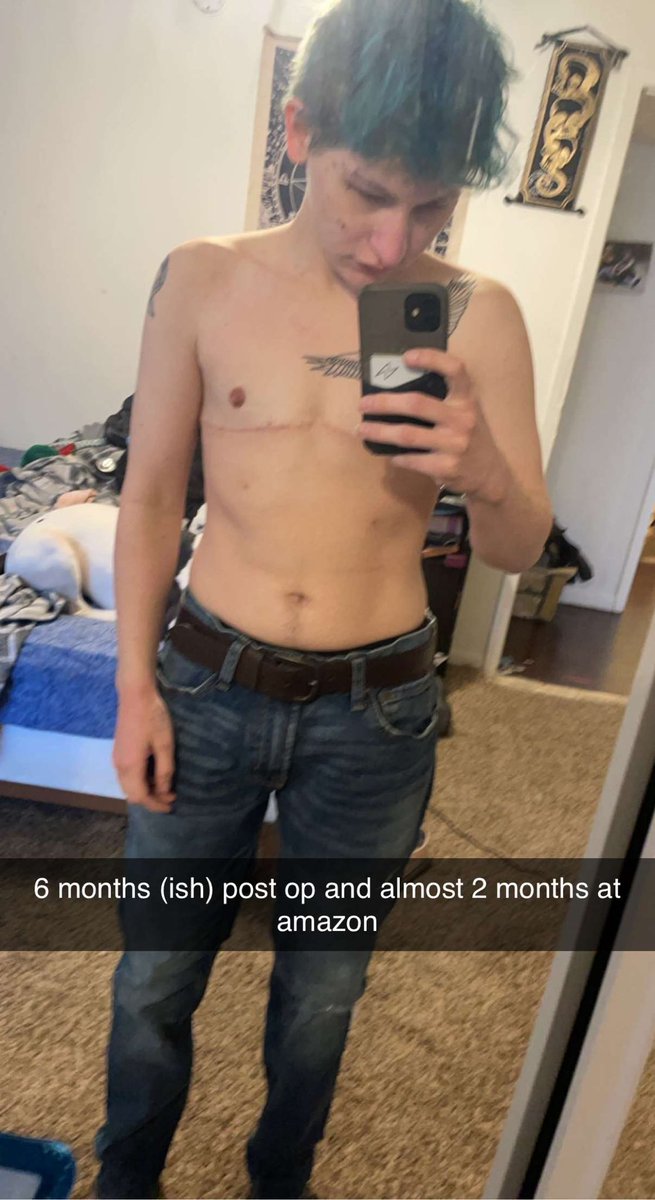 fun3ralR3d's tweet photo. testosterone and my wearhouse job and top surgery. DAMN https://t.co/TI812uR2xo