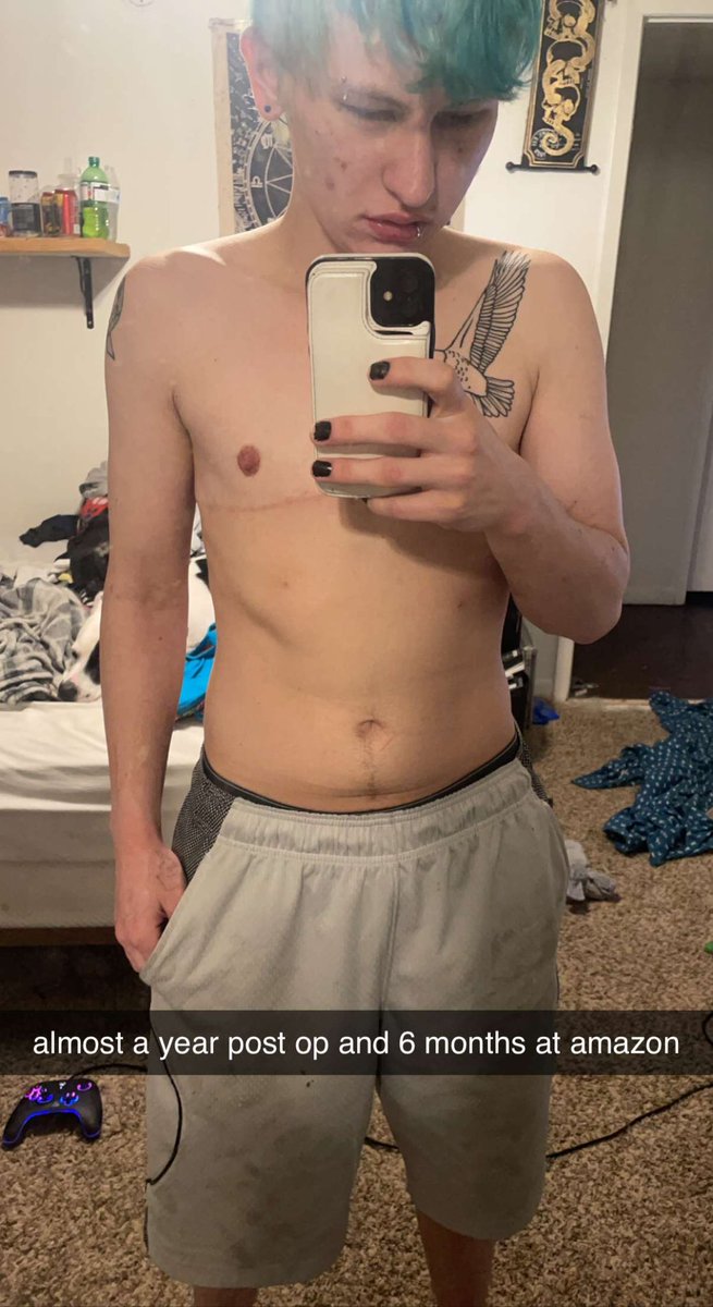 fun3ralR3d's tweet photo. testosterone and my wearhouse job and top surgery. DAMN https://t.co/TI812uR2xo