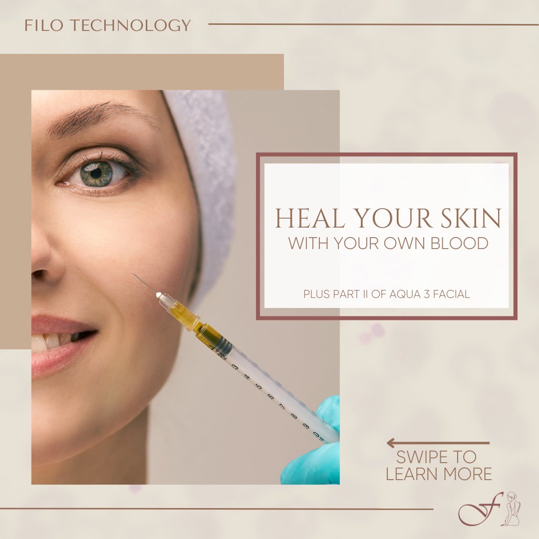 thefiloclinic's tweet image. 🪞 AQUA-3 Facial and Cellular Matrix 🧬
#prp #cellularmatrix #aestheticclinic